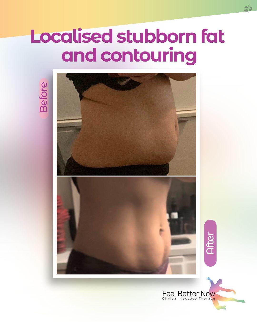 Stubborn Fat & Contouring